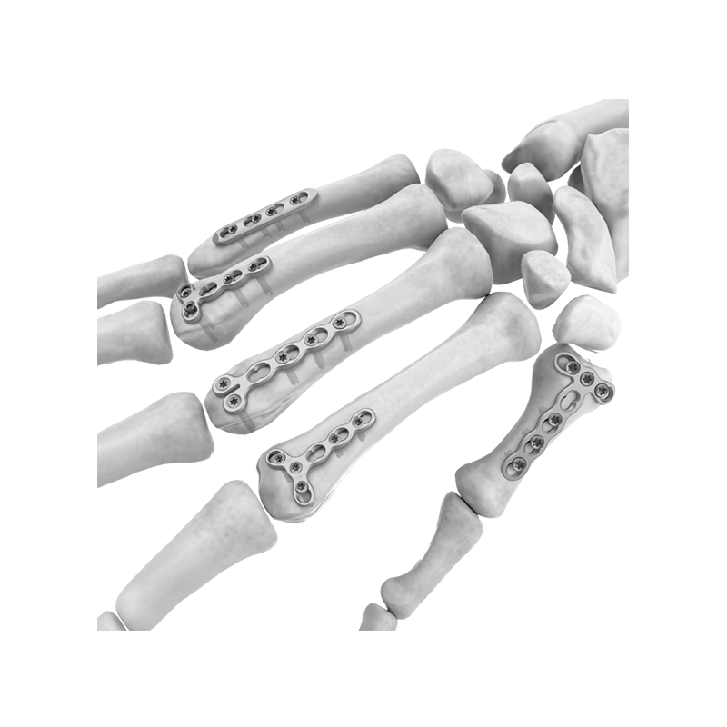 Biodegradable Miniature Hand and Foot System